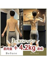 ワナ(WANNA)/20代男性のビフォーアフター