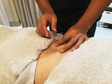 HAL鍼灸接骨院/*image*