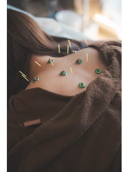 ヒノト(Hinoto)/身体の冷えに◎ 気持ちよいお灸