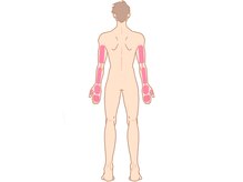 ダンディースター/【腕】脱毛の卒業目安