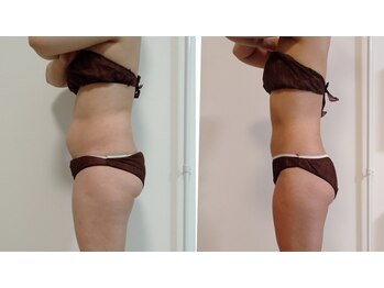 ラトゥリア(laturia)