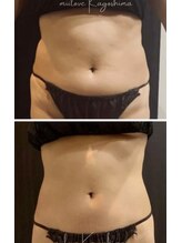 ミーラブ 鹿児島(miilove)/30代ビーナススワンお腹引き締め