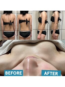 ミ ジュエル(me jewel)/肩こり/巻き肩/猫背解消/育乳