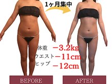 パルフェット(parfaite)/ブライダルに向けて、全身痩身