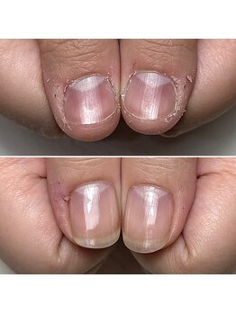 アンスリール(un sourire)/美爪育成