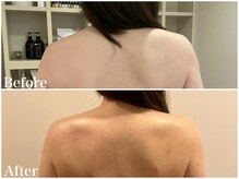 サロンドフェイス(Salon de Faith)/【ブライダル】3ケ月施術♪