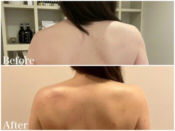 サロンドフェイス(Salon de Faith)/【ブライダル】3ケ月施術♪