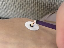 はりきゅう漫々の雰囲気（温熱効果で体の自然治癒力を高めながら心身の不調を整えます◎）