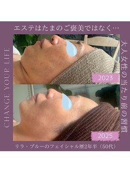 リラブルー(Lilas Bleu)/ハーブピーリング、美白メニュー