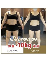 ワナ(WANNA)/30代女性のビフォーアフター