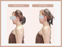 スリムライン 盛岡店(The Slim Line)/before→after