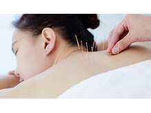 ファミリア鍼灸接骨院