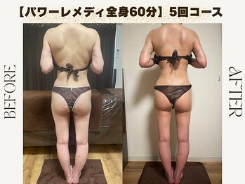 ルカ 北堀江(Luca)/肩こり改善したい方/痩身/肩こり