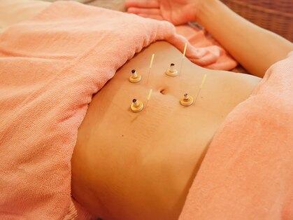 ハーリー 苦楽園(鍼利 HA-RI)の写真