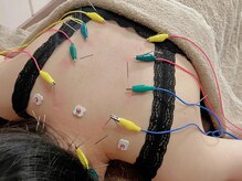 リム(Rim.)の雰囲気（人気の全身鍼灸で身体の疲れををreset！）