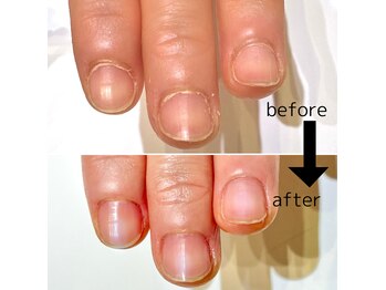 ネイルステーション イオンモール伊丹店(NAIL STATION)