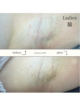 エヌアール(NR)/ladies 脇