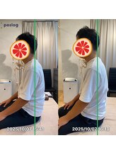 グレフル鍼灸接骨院 整体院 心斎橋/整体/肩こり/マッサージ/腰痛