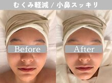 ミピマム 町田店/若い方でも人気な小顔サロン