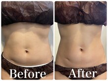 サロンドフェイス(Salon de Faith)の雰囲気（短期間で見た目痩せ！マシン取扱い多数で貴女に合うダイエット★）