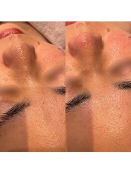 ビュウナ 銀座(BEAUNA)/ポテンザ