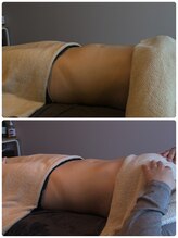 ティエルプラス(tiele+)/骨盤調整×HOT腸もみ