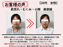 サロンスマイル/20代美容鍼ビフォーアフター