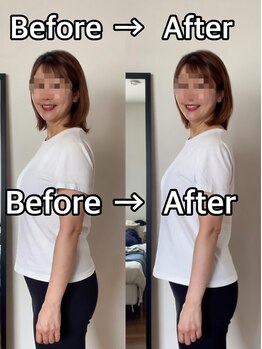 ビースリム(Be Slim)/Before⇔After