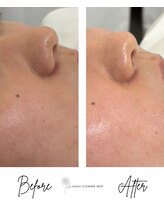 サロン コムモア(salon COMME MOI)/BeforeAfter