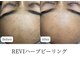 マテオ(Matteo)の写真