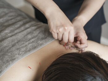 エール(AILE)の写真/女性鍼灸マッサージ師が一人ひとりのお悩みに合わせて施術