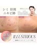 【シミケア/紫外線ダメージ】内側から透明感を作る美白ケア★イラストリアス