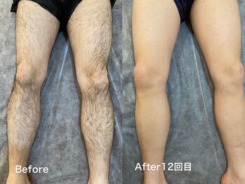 エリクサー 太田店(Elixir)の写真/【メンズ全身脱毛】メンズ全身脱毛メニューあり！完全個室で安心してムダ毛ケア♪