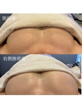 シーズボーテ(C's Beaute)/エイジングサロンのバストアップ