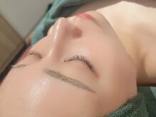 ビハニエル/陶肌トリートメントＮＭＮ