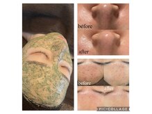 ラナ(LaNa)の雰囲気（ハーブピーリングでお肌の変化が凄い★初回お得なクーポン有◎）