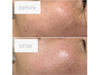 ウェヌ(VENE)/マツヤニWAXのbefore/after