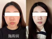 エール(aile)/気になる歪み、左右差にお勧め