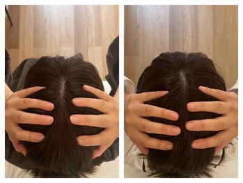 ユーフォー(UfoR)/【Before/After】ヘッドスパ