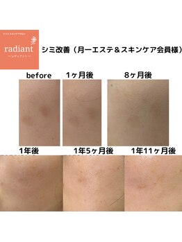 レディアント 石神井公園(radiant)/石神井公園/フェイシャル