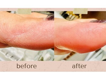 ルミエールサント(lumiere sainte)/フットケアスペシャルコース♪