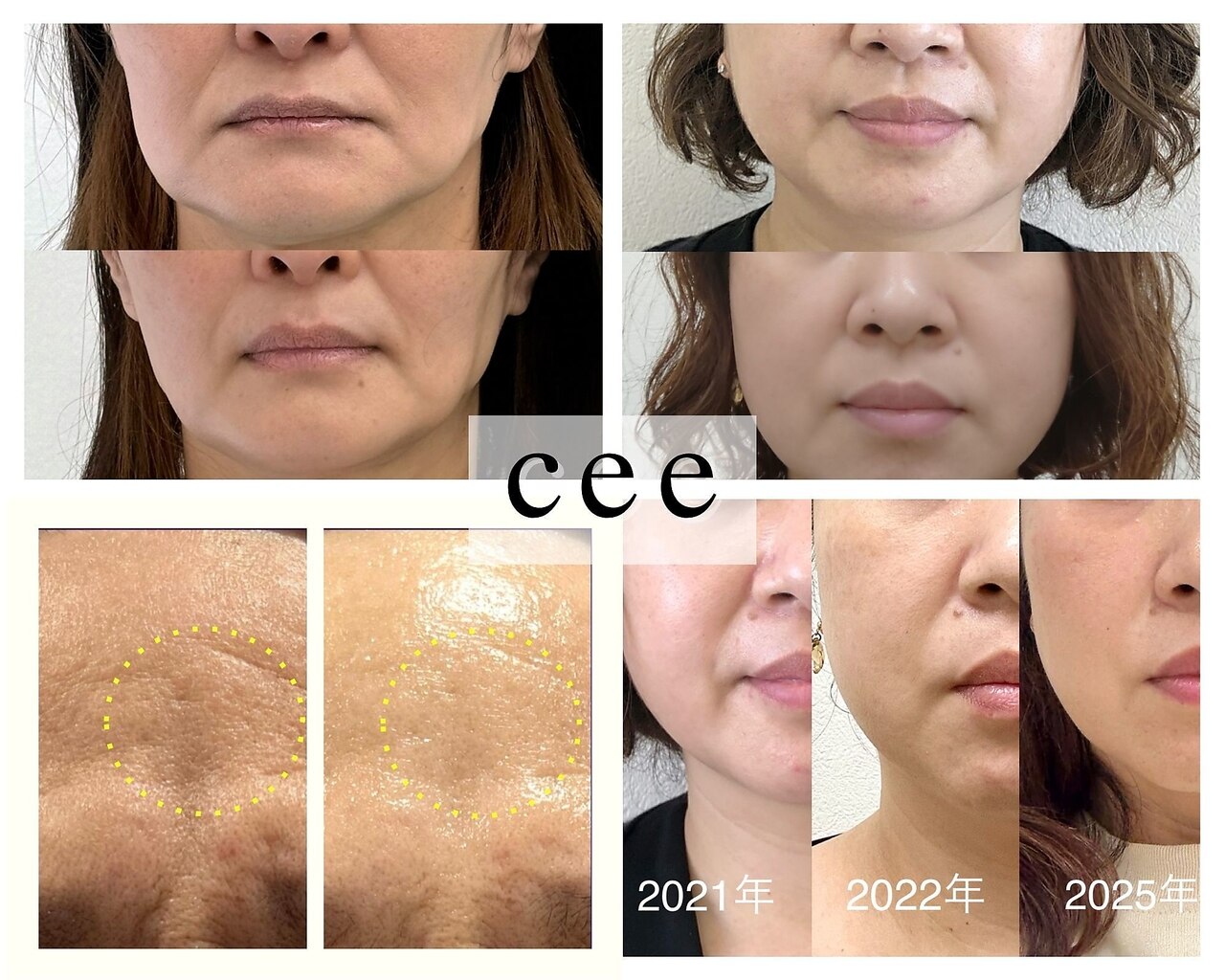 エイジングケアサロンシー(aging care salon cee)｜ホットペッパー