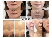 エイジングケアサロンシー(aging care salon cee)