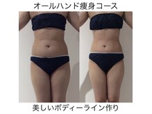 ラヴィ(Ravi)の雰囲気（オールハンド全身痩身コース150分）