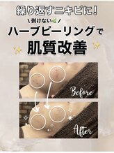 ビレボ マエバシ(BEREVO maebashi)/Before After