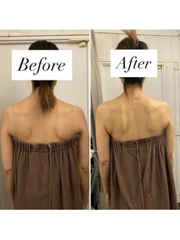 リラル(RERAR)/全身リンパ60分＋ヘッドスパ20分