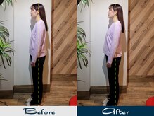 ハカハカ(HAKA HAKA)/ZERO トータルバランス美容矯正