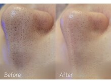 ミナミ/水光肌ララピール