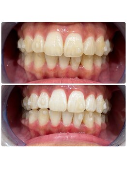 コナホワイトニング 神保町/セルフホワイトニング神保町