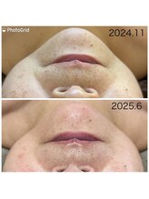 private salon Ponola【ポノーラ】/ラミネーションピール